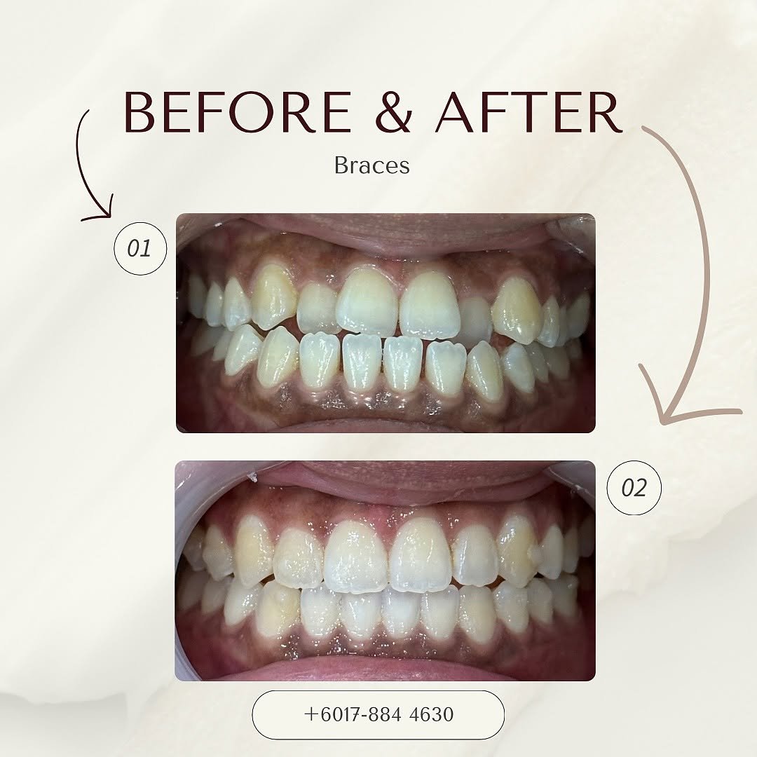 before after delight dental 2