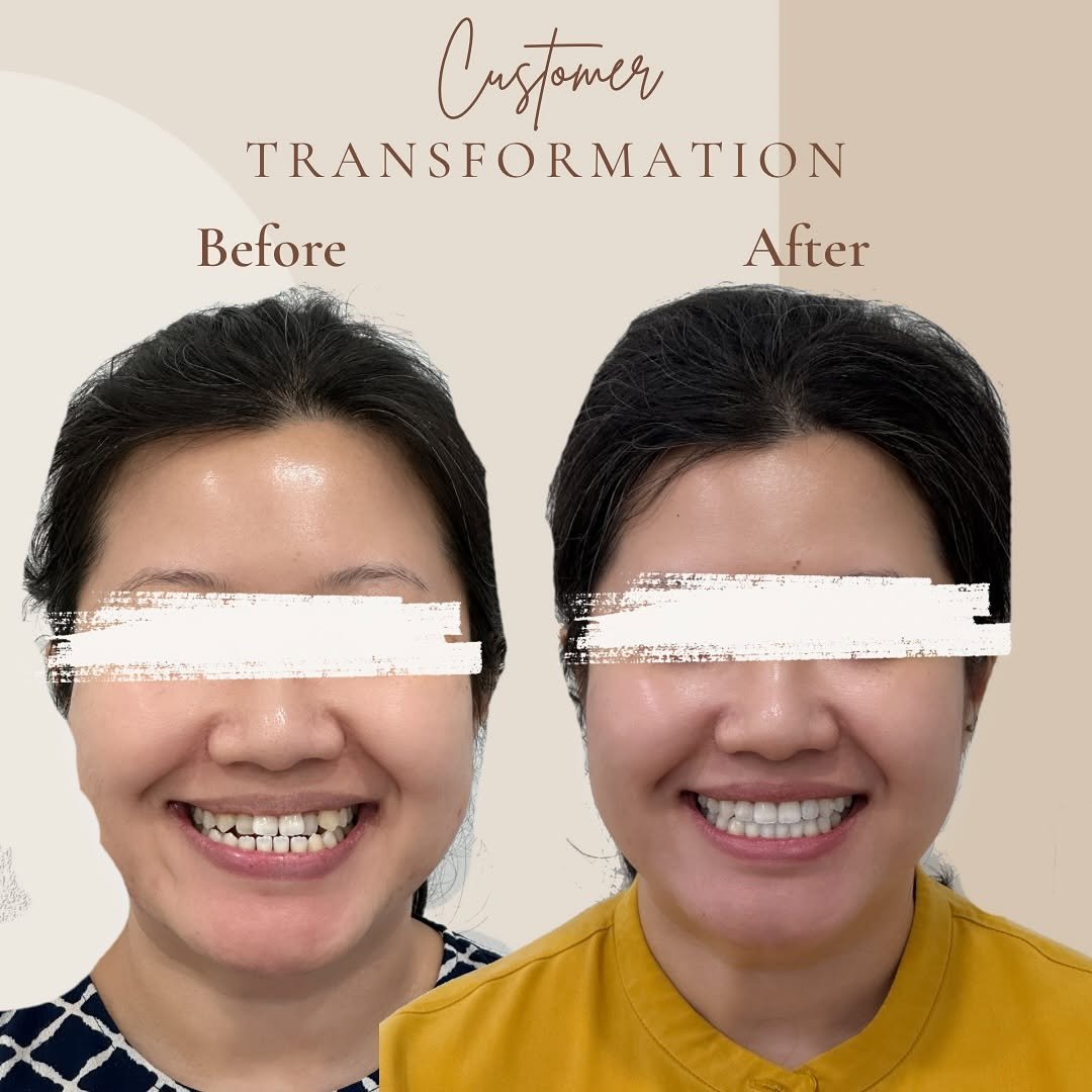 customer transformation delight dental2