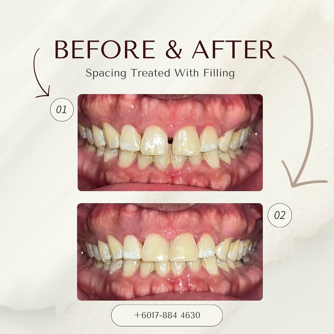 General dentistry before and after comparison 7