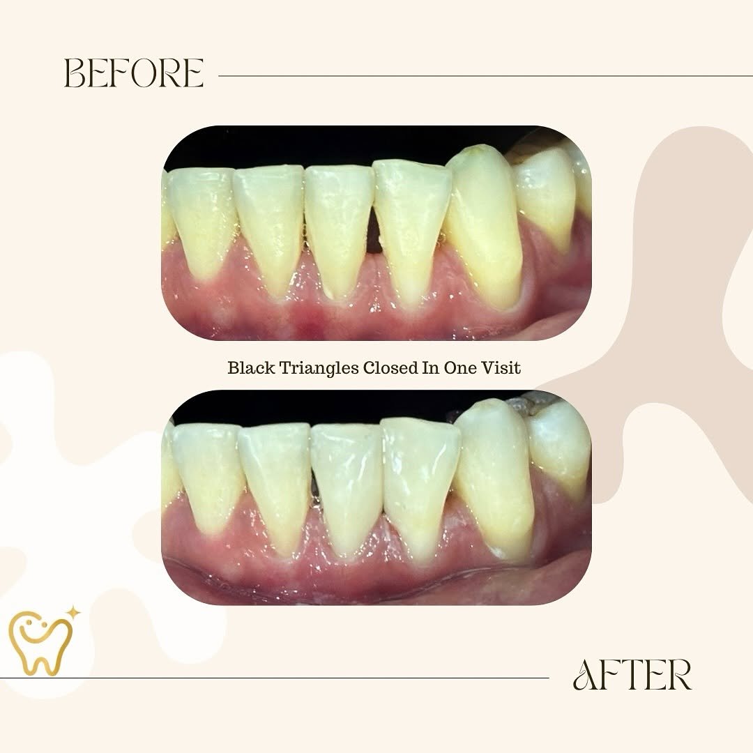 General dentistry before and after comparison 8