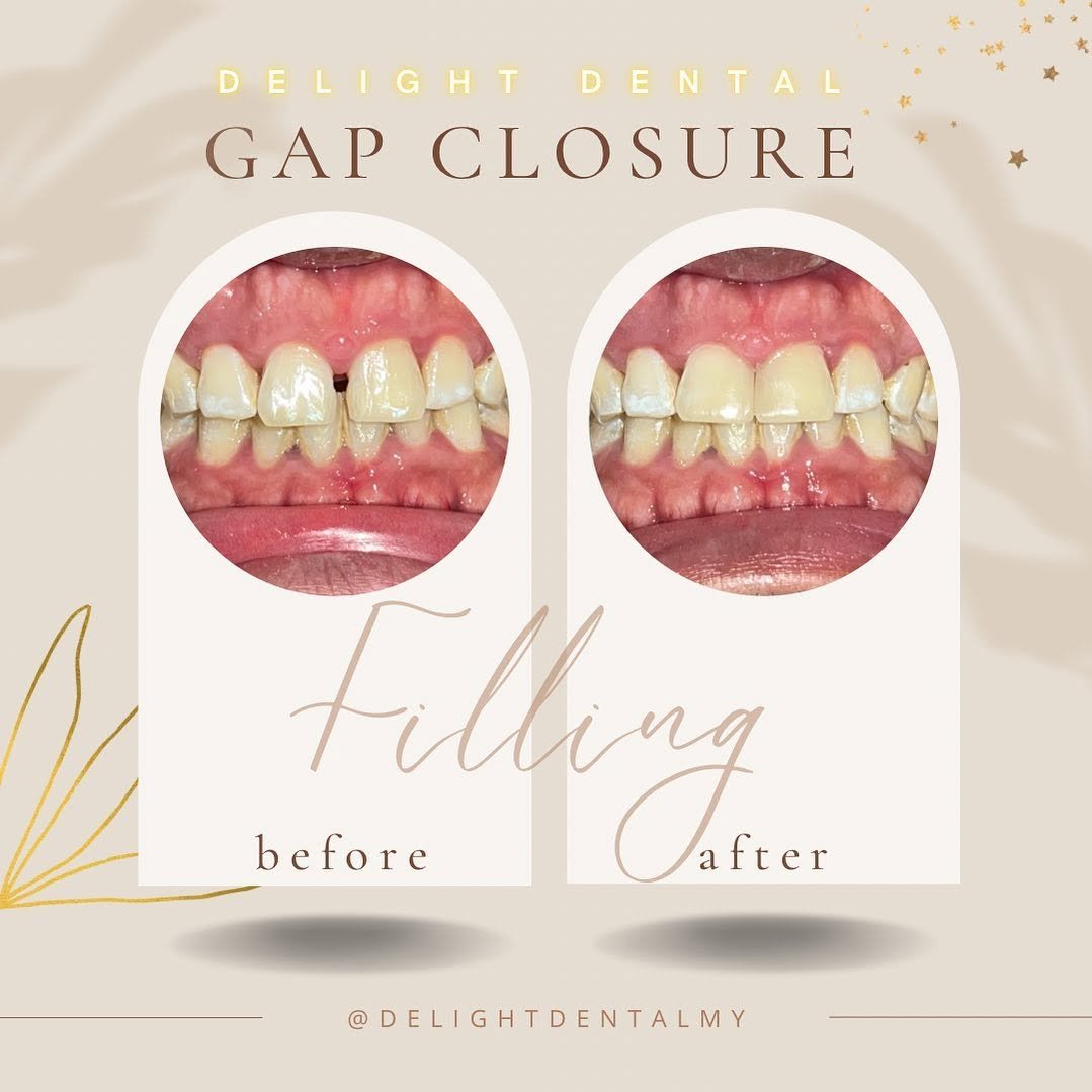 General dentistry before and after comparison 9