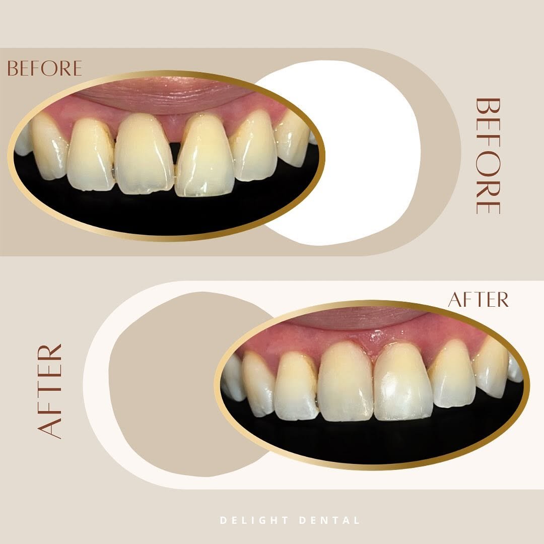 General dentistry before and after comparison 6